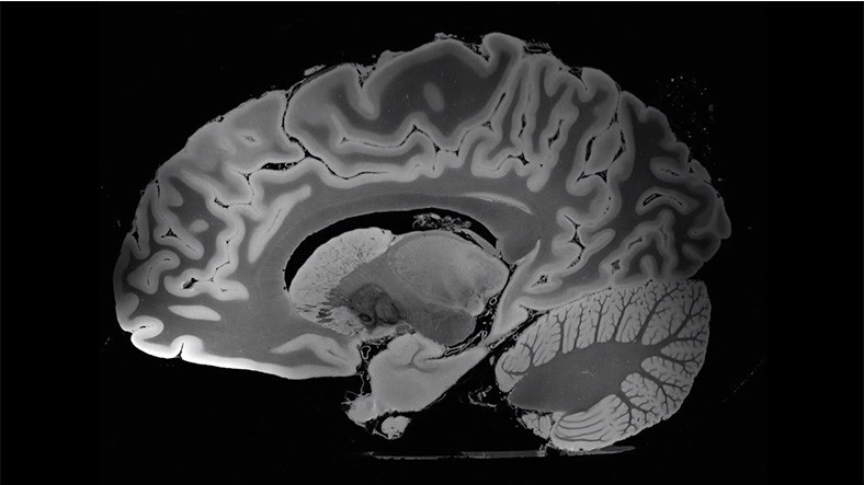 100 Saat MR'da Kalan İnsan Beyninin İnanılmaz Görüntüsü